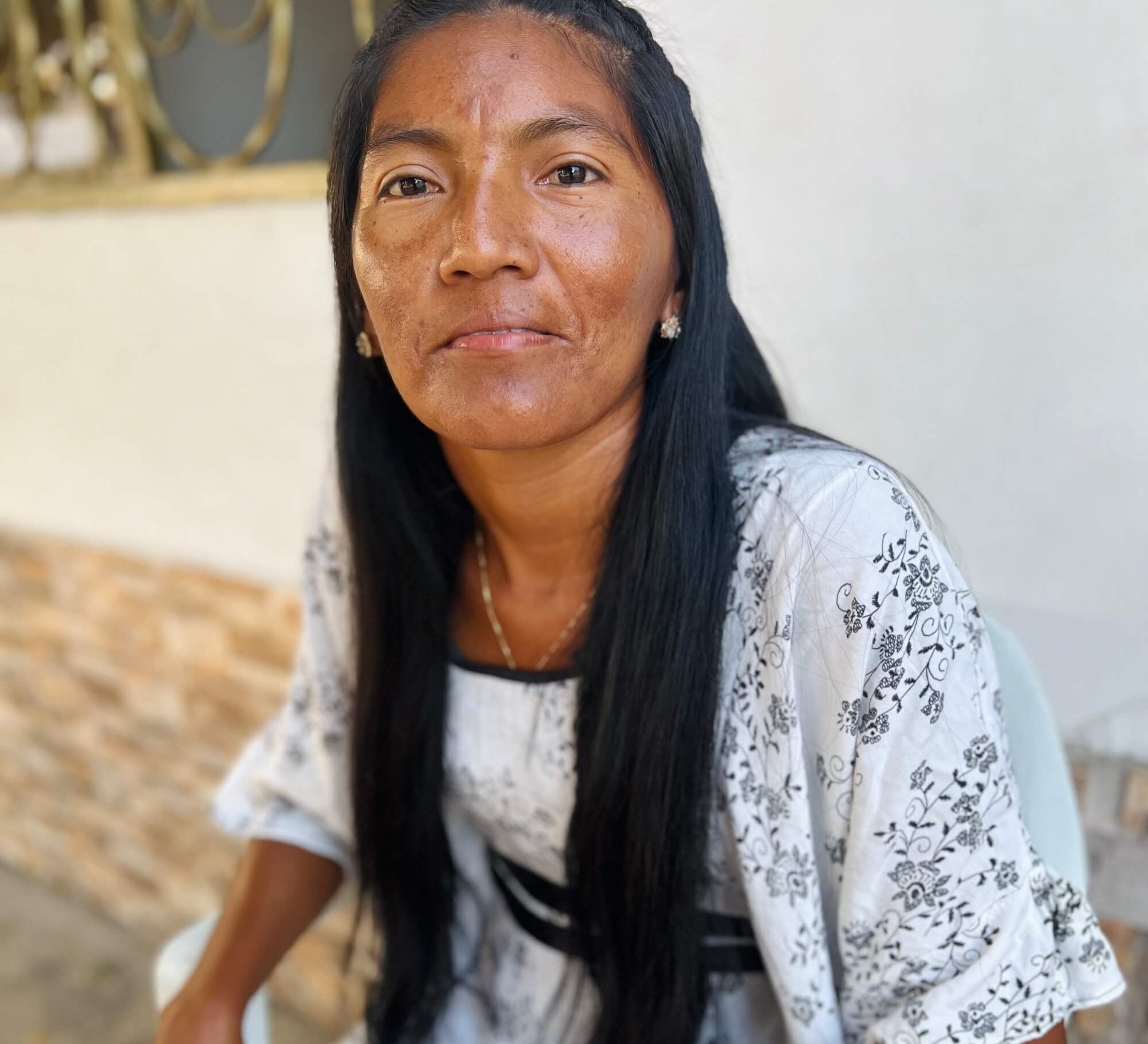 Woman sitting outdoors wearing a light-colored dress with floral patterns.